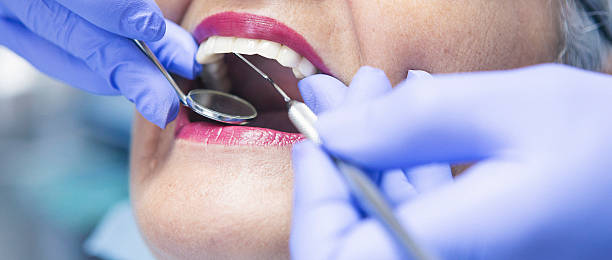 Best Emergency Treatment for Oral Infections in Delphi, IN